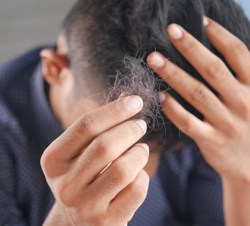 4 Helpful Hair Loss Solutions You Want to Know About